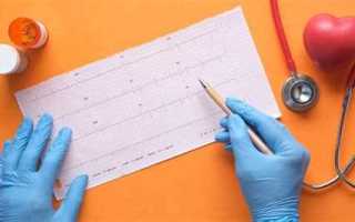 Как прикрепиться к поликлинике в москве иногородним