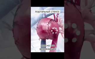 Порок сердца как уволиться из мвд