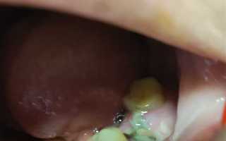 Удалили не тот зуб куда жаловаться