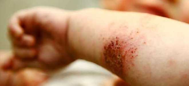 Какие повреждения относятся к микротравмам