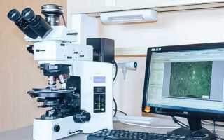 С какой целью проводится исследование микроструктуры металла