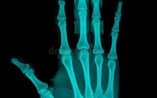 Как забрать снимок рентгена из поликлиники