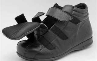 Кому положена бесплатная ортопедическая обувь