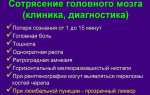 За сотрясение мозга какое наказание грозит