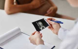 Сколько действует квота на эко