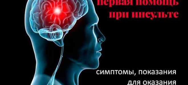 Почему не пускают в реанимацию при инсульте