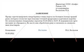 Что является основанием для регистрации микротравмы работника