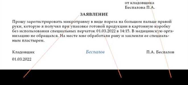 Что является основанием для регистрации микротравмы работника