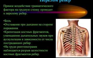Что недопустимо делать при оказании помощи пострадавшему сбербанк