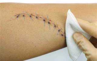 Через какое время снимают с учета в психдиспансере