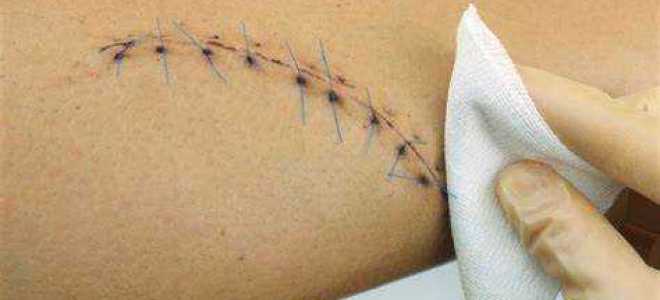 Через какое время снимают с учета в психдиспансере