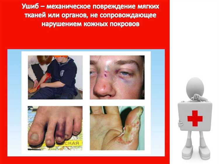 Какие травмы классифицируются как тяжкие телесные повреждения