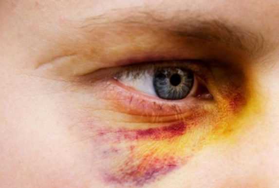 Порядок документального оформления признаков тяжких повреждений