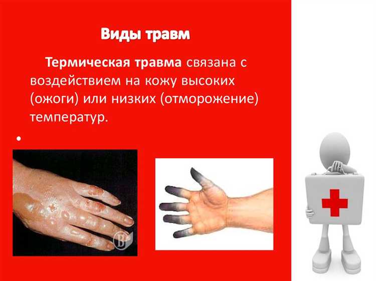 Что относится к тяжким телесным повреждениям Что относится к тяжким телесным повреждениям