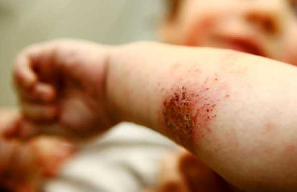 Ошибки разработчиков тестов, приводящие к возникновению микротравм