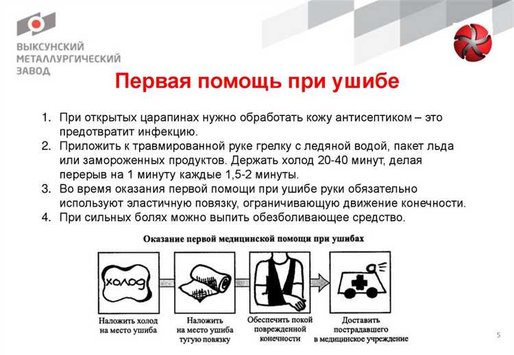 Что считается производственной травмой по закону