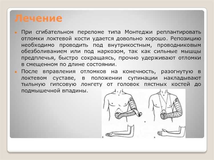 Рекомендации по правильному оформлению разрешённых отметок на когте