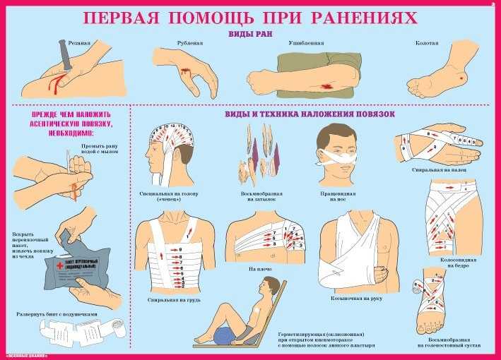 Чем опасна самостоятельная попытка устранить причину инцидента