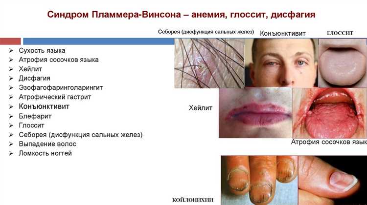 Применение материалов с группой В1 в строительстве