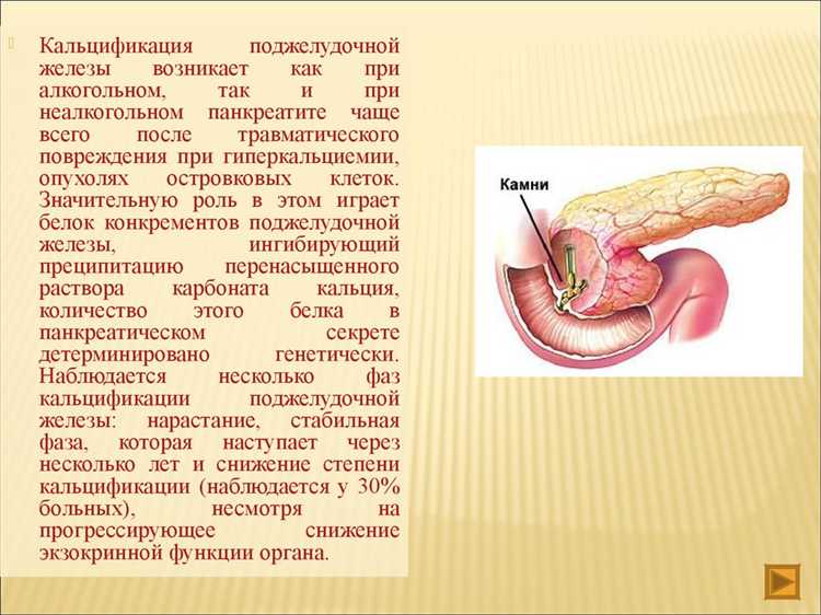 Как хронический панкреатит влияет на работоспособность и физическое состояние
