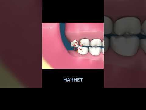 Куда обращаться с жалобой на стоматолога