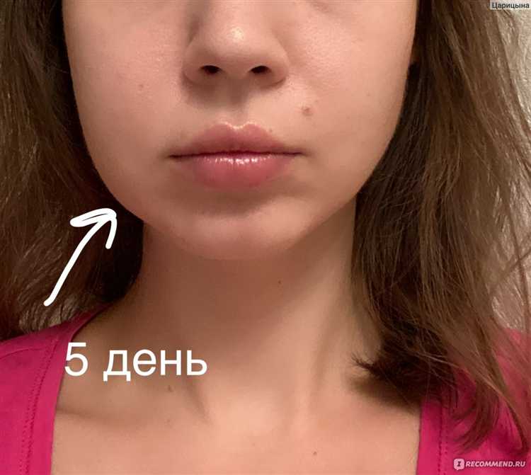 Как зафиксировать медицинскую ошибку