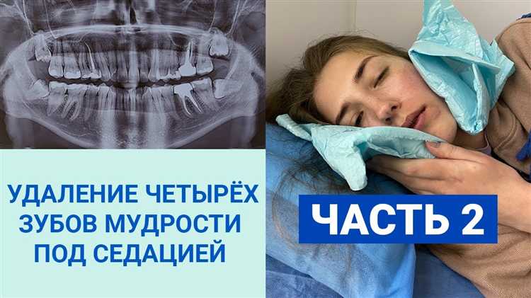 Какие документы запросить у стоматолога после удаления