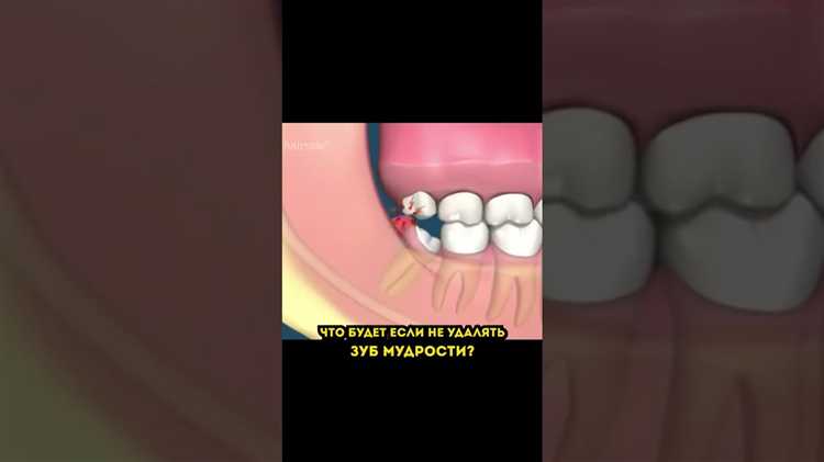 Можно ли требовать компенсацию и как это сделать