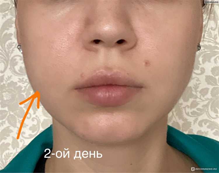 Что делать, если удалили не тот зуб: куда жаловаться