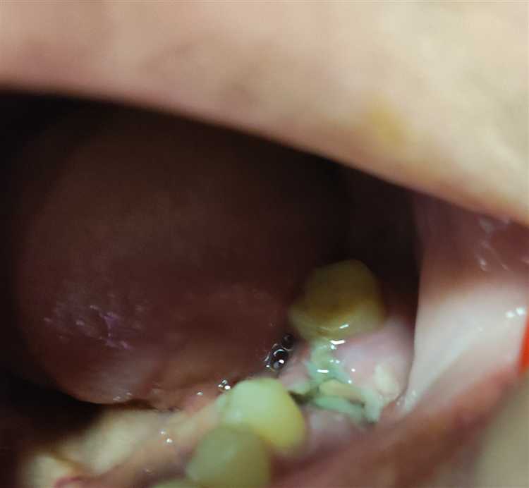 Удалили не тот зуб куда жаловаться Удалили не тот зуб куда жаловаться