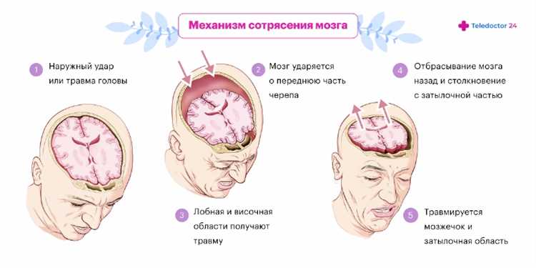 Ответственность за сотрясение мозга, причинённое по неосторожности