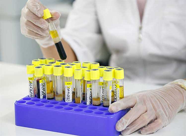 Как получить результаты анализов через интернет-портал поликлиники?