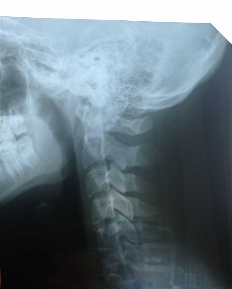 Как забрать рентгеновский снимок за другого человека