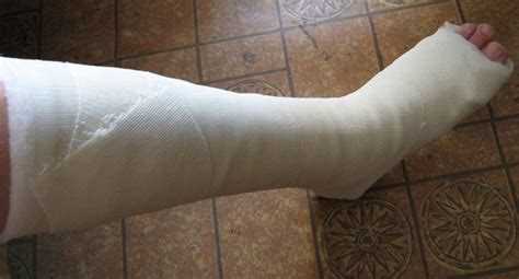 Можно ли получить рентгеновский снимок в электронном виде