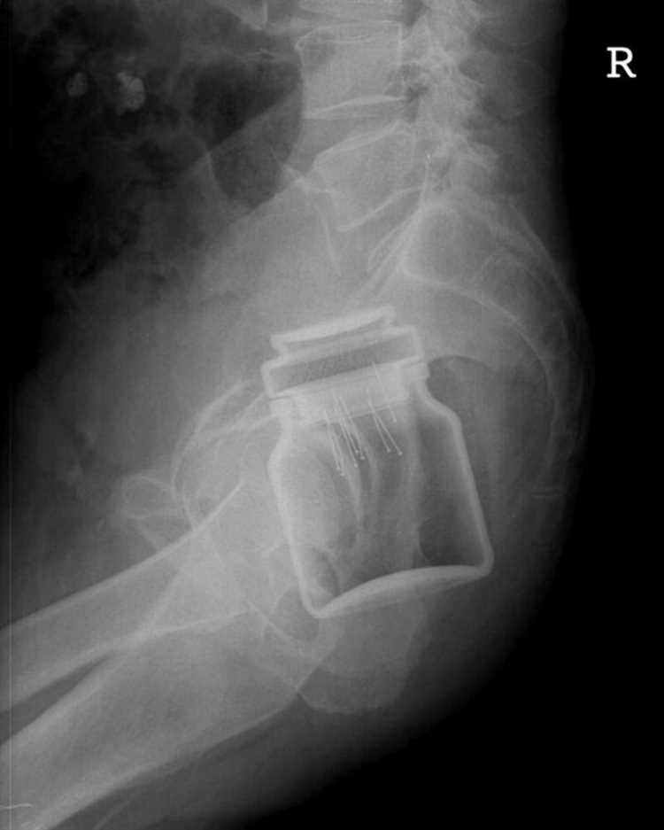 Где именно в поликлинике выдают готовые снимки