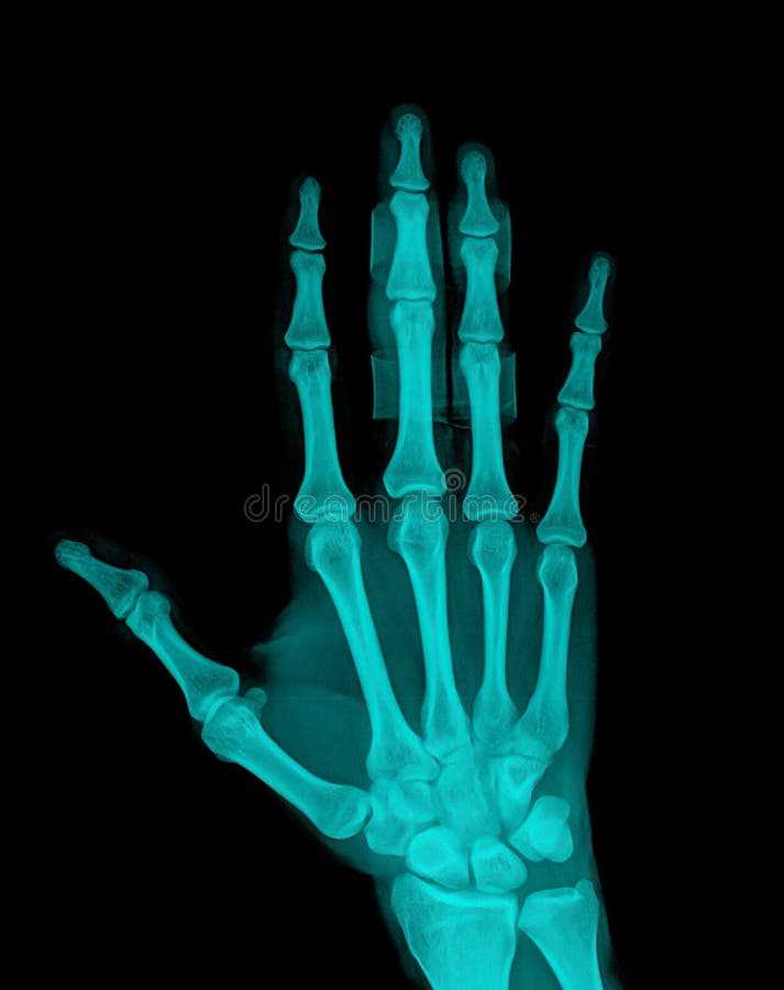 Как забрать снимок рентгена из поликлиники Как забрать снимок рентгена из поликлиники