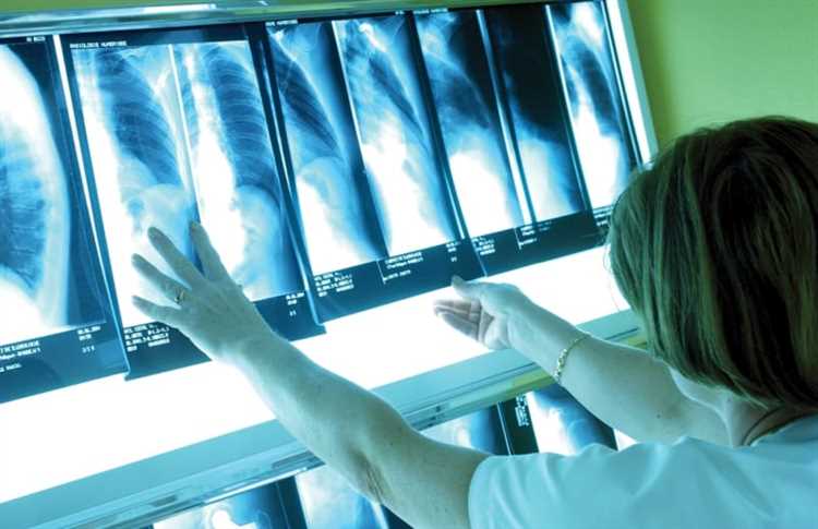Как часто медработникам Москвы требуется проходить флюорографию по закону?