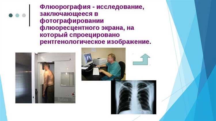 Порядок прохождения флюорографии в государственных учреждениях здравоохранения Москвы