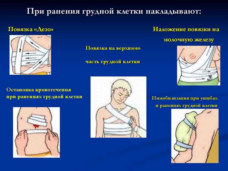 Повреждения грудной клетки, сопровождающиеся нарушением дыхания