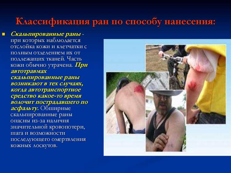 Виды ранений, относящихся к тяжелым