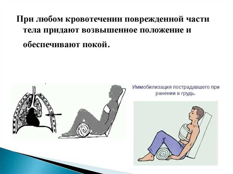 Ранения, вызывающие обильную кровопотерю и шоковые состояния