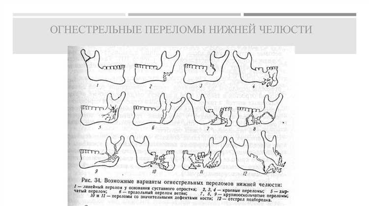 Комбинированные ранения с поражением нескольких органов или систем