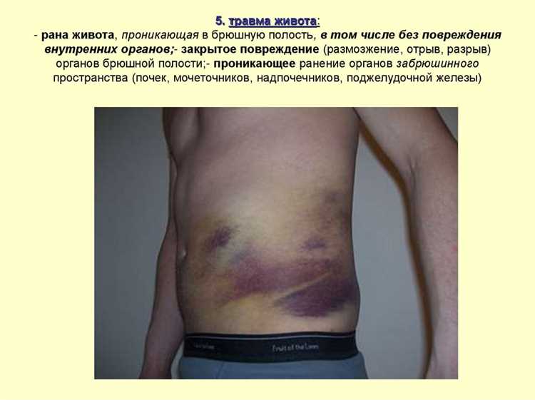 Осложненные переломы костей с риском для жизни