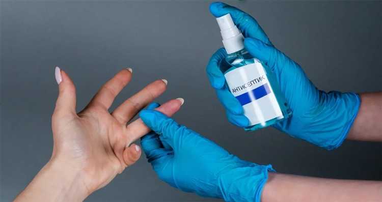 Условия освобождения от СГР при реализации остатков продукции