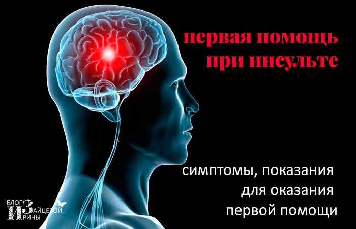 Почему не пускают в реанимацию при инсульте