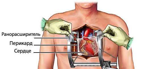 Порядок оформления увольнения по медицинским показаниям в МВД