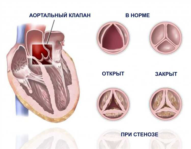 Обжалование решения об увольнении при пороке сердца: порядок и сроки