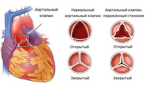 Права и социальные гарантии сотрудника МВД при увольнении по болезни сердца