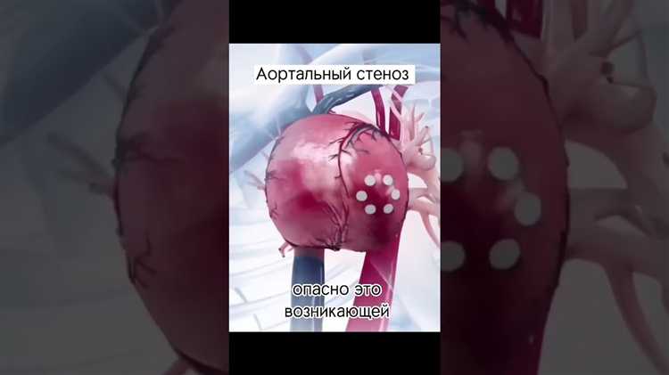 Порок сердца как уволиться из мвд Порок сердца как уволиться из мвд