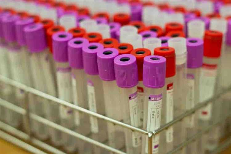 Какие меры можно принять для предотвращения потери анализов в будущем